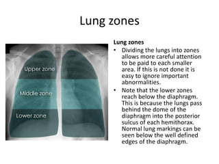 Lung zones
Lung zones
• Dividing the lungs into zones
allows more careful attention
to be paid to each smaller
area. If this is not done it is
easy to ignore important
abnormalities.
• Note that the lower zones
reach below the diaphragm.
This is because the lungs pass
behind the dome of the
diaphragm into the posterior
sulcus of each hemithorax.
Normal lung markings can be
seen below the well defined
edges of the diaphragm.
 