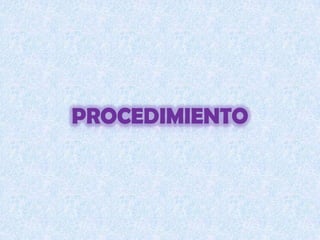 procedimiento