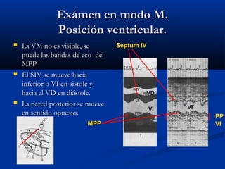 Exámen en modo M.
               Posición ventricular.
   La VM no es visible, se       Septum IV
    puede las bandas de eco del
    MPP
   El SIV se mueve hacia
    inferior o VI en sistole y
    hacia el VD en diástole.                  VD
   La pared posterior se mueve                    VI
                                              VI
    en sentido opuesto.                                 PP
                         MPP                            VI
 