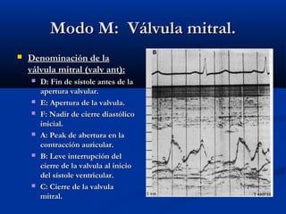 Modo M: Válvula mitral.
   Denominación de la
    válvula mitral (valv ant):
       D: Fin de sístole antes de la
        apertura valvular.
       E: Apertura de la valvula.
       F: Nadir de cierre diastólico
        inicial.
       A: Peak de abertura en la
        contracción auricular.
       B: Leve interrupción del
        cierre de la valvula al inicio
        del sístole ventricular.
       C: Cierre de la valvula
        mitral.
 