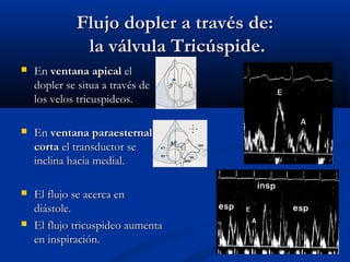 Flujo dopler a través de:Flujo dopler a través de:
la válvula Tricúspide.la válvula Tricúspide.
 EnEn ventana apicalventana apical elel
dopler se situa a través dedopler se situa a través de
los velos tricuspideos.los velos tricuspideos.
 EnEn ventana paraesternalventana paraesternal
cortacorta el transductor seel transductor se
inclina hacia medial.inclina hacia medial.
 El flujo se acerca enEl flujo se acerca en
diástole.diástole.
 El flujo tricuspideo aumentaEl flujo tricuspideo aumenta
en inspiración.en inspiración.
 