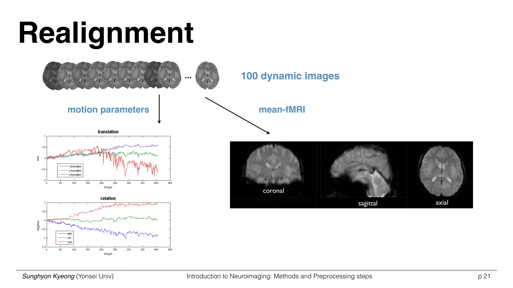 Sunghyon Kyeong (Yonsei Univ) Introduction to Neuroimaging: Methods and Preprocessing steps p
Realignment
21
...
motion parameters mean-fMRI
sagittal
coronal
axial
100 dynamic images
 