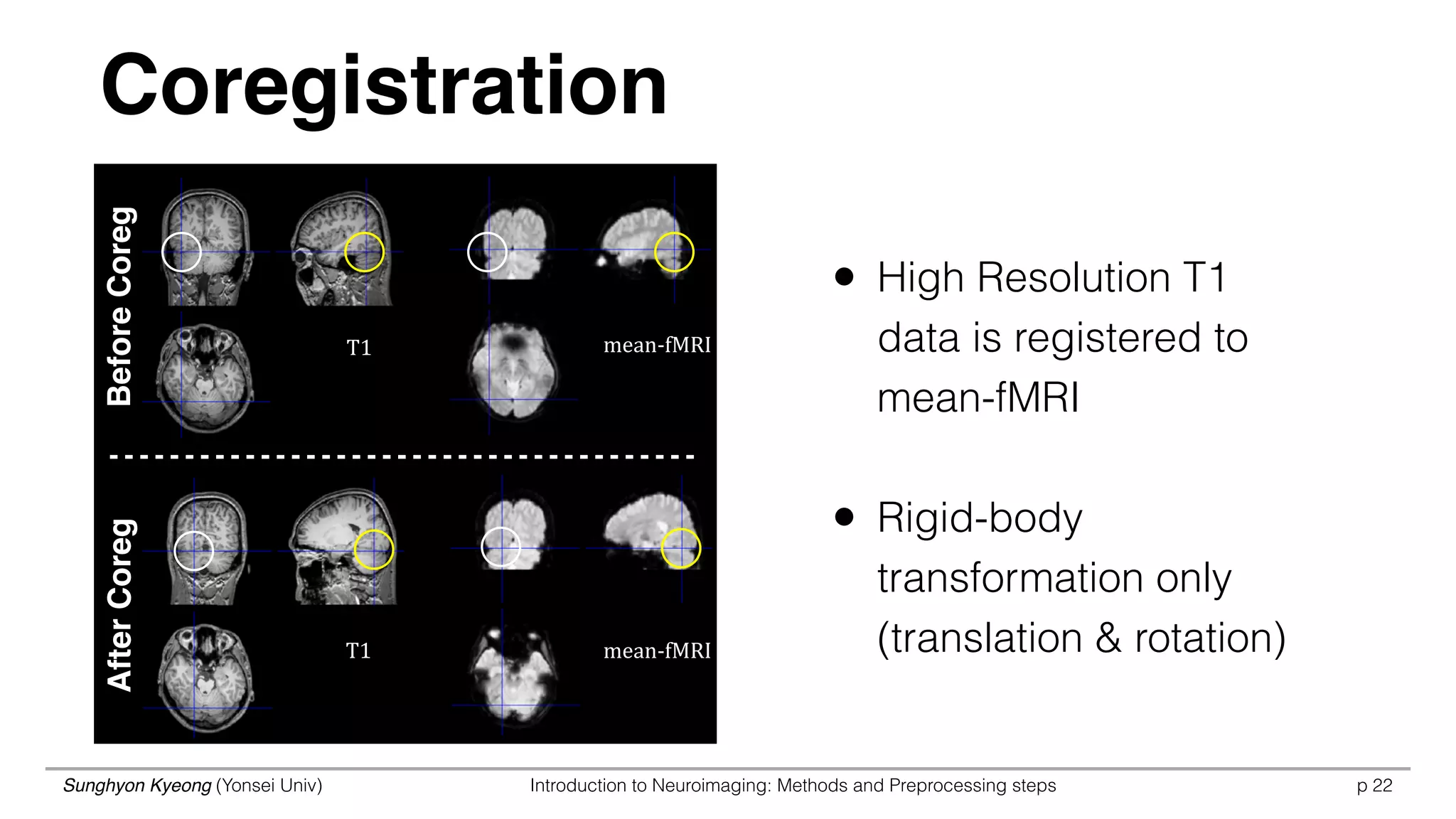 Sunghyon Kyeong (Yonsei Univ) Introduction to Neuroimaging: Methods and Preprocessing steps p
Coregistration
22
BeforeCoregAfterCoreg
• High Resolution T1
data is registered to
mean-fMRI
• Rigid-body
transformation only 
(translation & rotation)
T1 mean-­‐fMRI
T1 mean-­‐fMRI
 