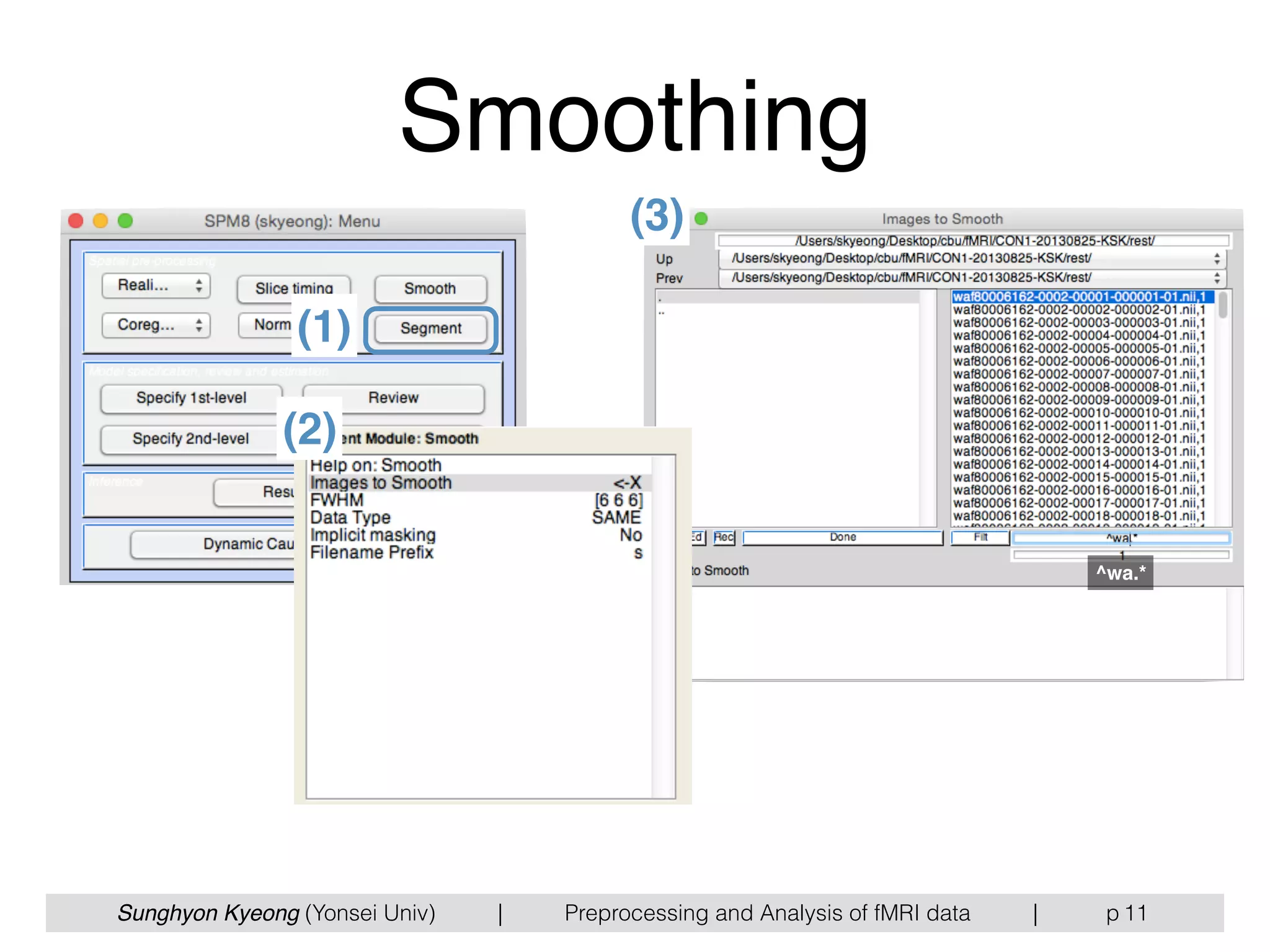 Sunghyon Kyeong (Yonsei Univ) | Preprocessing and Analysis of fMRI data | p
Smoothing
11
(1)
(2)
(3)
^wa.*
 