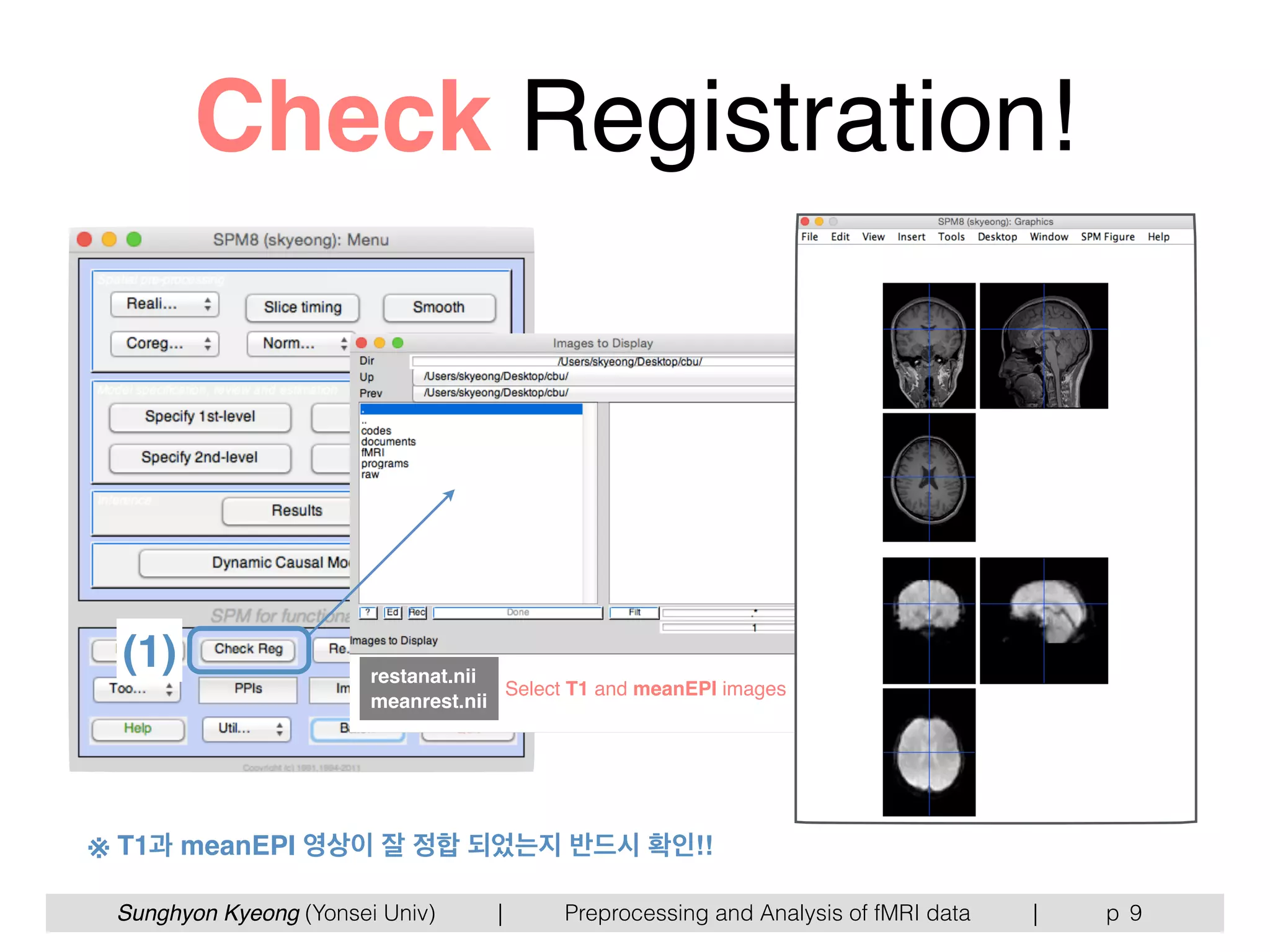 Sunghyon Kyeong (Yonsei Univ) | Preprocessing and Analysis of fMRI data | p
Check Registration!
9
(1) restanat.nii
meanrest.nii
Select T1 and meanEPI images
※ T1과 meanEPI 영상이 잘 정합 되었는지 반드시 확인!!
 