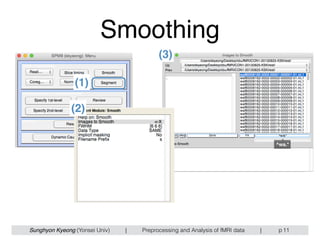 Sunghyon Kyeong (Yonsei Univ) | Preprocessing and Analysis of fMRI data | p
Smoothing
11
(1)
(2)
(3)
^wa.*
 