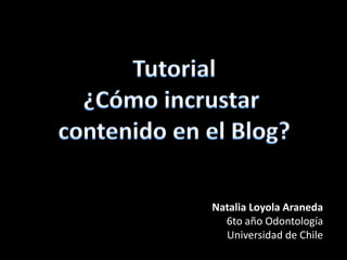 Natalia Loyola Araneda
  6to año Odontología
  Universidad de Chile
 