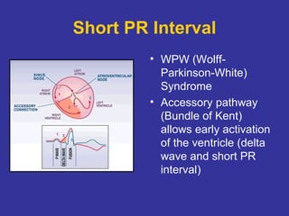 Tutorial in Basic ECG for Medical Students | PPT