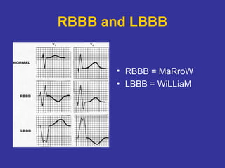 Tutorial in Basic ECG for Medical Students | PPT