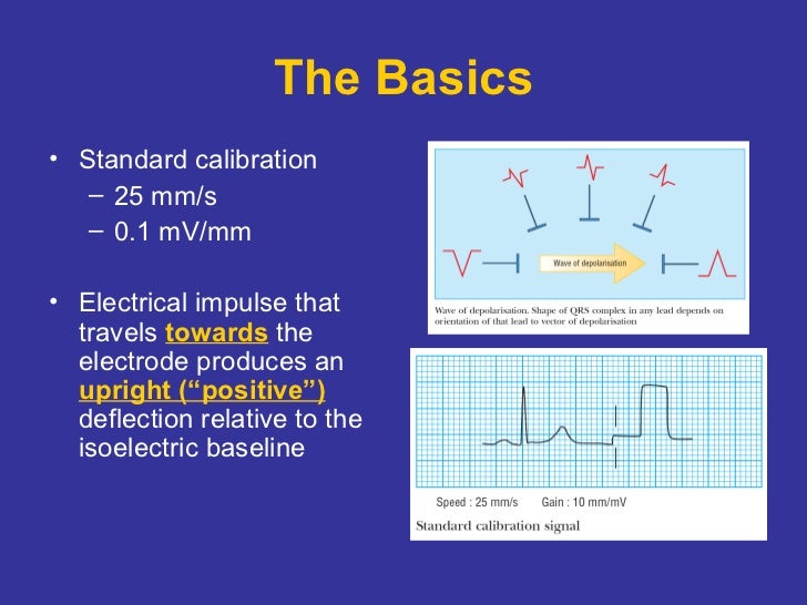 Tutorial in Basic ECG for Medical Students