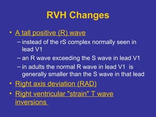 Tutorial in ecg | PPT