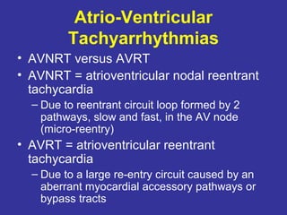 Tutorial in ecg | PPT