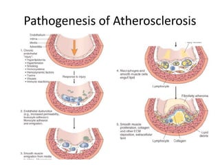 Pathogenesis of Atherosclerosis
 