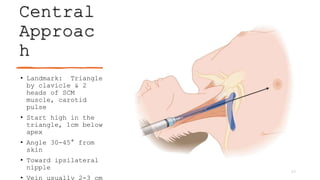 Central
Approac
h
• Landmark: Triangle
by clavicle & 2
heads of SCM
muscle, carotid
pulse
• Start high in the
triangle, 1cm below
apex
• Angle 30-45° from
skin
• Toward ipsilateral
nipple
• Vein usually 2-3 cm
33
 