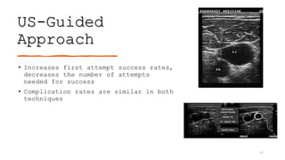 US-Guided
Approach
• Increases first attempt success rates,
decreases the number of attempts
needed for success
• Complication rates are similar in both
techniques
36
 