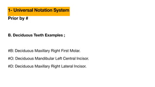 Prior by #
B. Deciduous Teeth Examples ;
#B: Deciduous Maxillary Right First Molar.
#O: Deciduous Mandibular Left Central Incisor.
#D: Deciduous Maxillary Right Lateral Incisor.
1- Universal Notation System
 