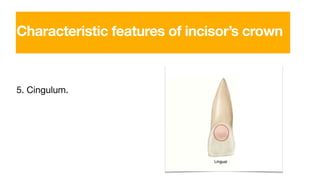 5. Cingulum.
Characteristic features of incisor’s crown
 