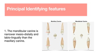 Principal Identifying features
1. The mandibular canine is
narrower mesio-distally and
labio-lingually than the
maxillary canine.
Maxillary Canine Mandibular Canine
 