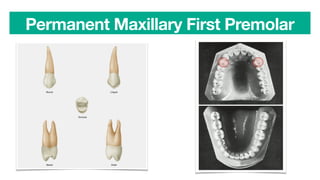 Permanent Maxillary First Premolar
 