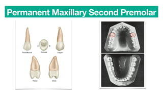 Permanent Maxillary Second Premolar
 