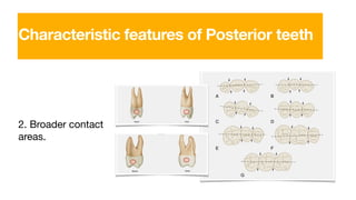 2. Broader contact
areas.
Characteristic features of Posterior teeth
 