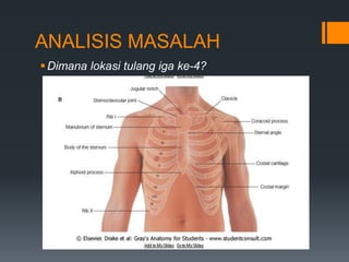 ANALISIS MASALAH
 Dimana lokasi tulang iga ke-4?
 