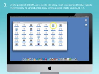 3. Zvoľte priečinok DICOM. Ak si nie ste istí, ktorý z nich je priečinok DICOM, vyberte
všetky súbory na CD alebo USB disku s myšou alebo stlačte Command + A.
 