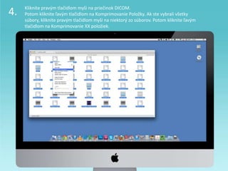 4. Kliknite pravým tlačidlom myši na priečinok DICOM.
Potom kliknite ľavým tlačidlom na Komprimovanie Položky. Ak ste vybrali všetky
súbory, kliknite pravým tlačidlom myši na niektorý zo súborov. Potom kliknite ľavým
tlačidlom na Komprimovanie XX položiek.
 