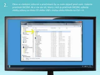 2. Okno so všetkými súbormi a priečinkami by sa malo objaviť pred vami. Vyberte
priečinok DICOM. Ak si nie ste istí, ktorý z nich je priečinok DICOM, vyberte
všetky súbory na disku CD alebo USB s myšou alebo kliknite na Ctrl + A.
 