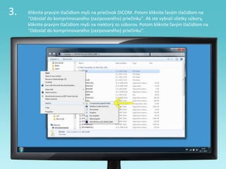 3. Kliknite pravým tlačidlom myši na priečinok DICOM. Potom kliknite ľavým tlačidlom na
"Odoslať do komprimovaného (zazipovaného) priečinku". Ak ste vybrali všetky súbory,
kliknite pravým tlačidlom myši na niektorý zo súborov. Potom kliknite ľavým tlačidlom na
"Odoslať do komprimovaného (zazipovaného) priečinku".
 