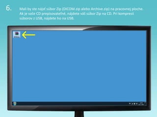 6. Mali by ste nájsť súbor Zip (DICOM.zip alebo Archive.zip) na pracovnej ploche.
Ak je vaše CD prepisovateľné, nájdete váš súbor Zip na CD. Pri kompresii
súborov z USB, nájdete ho na USB.
 