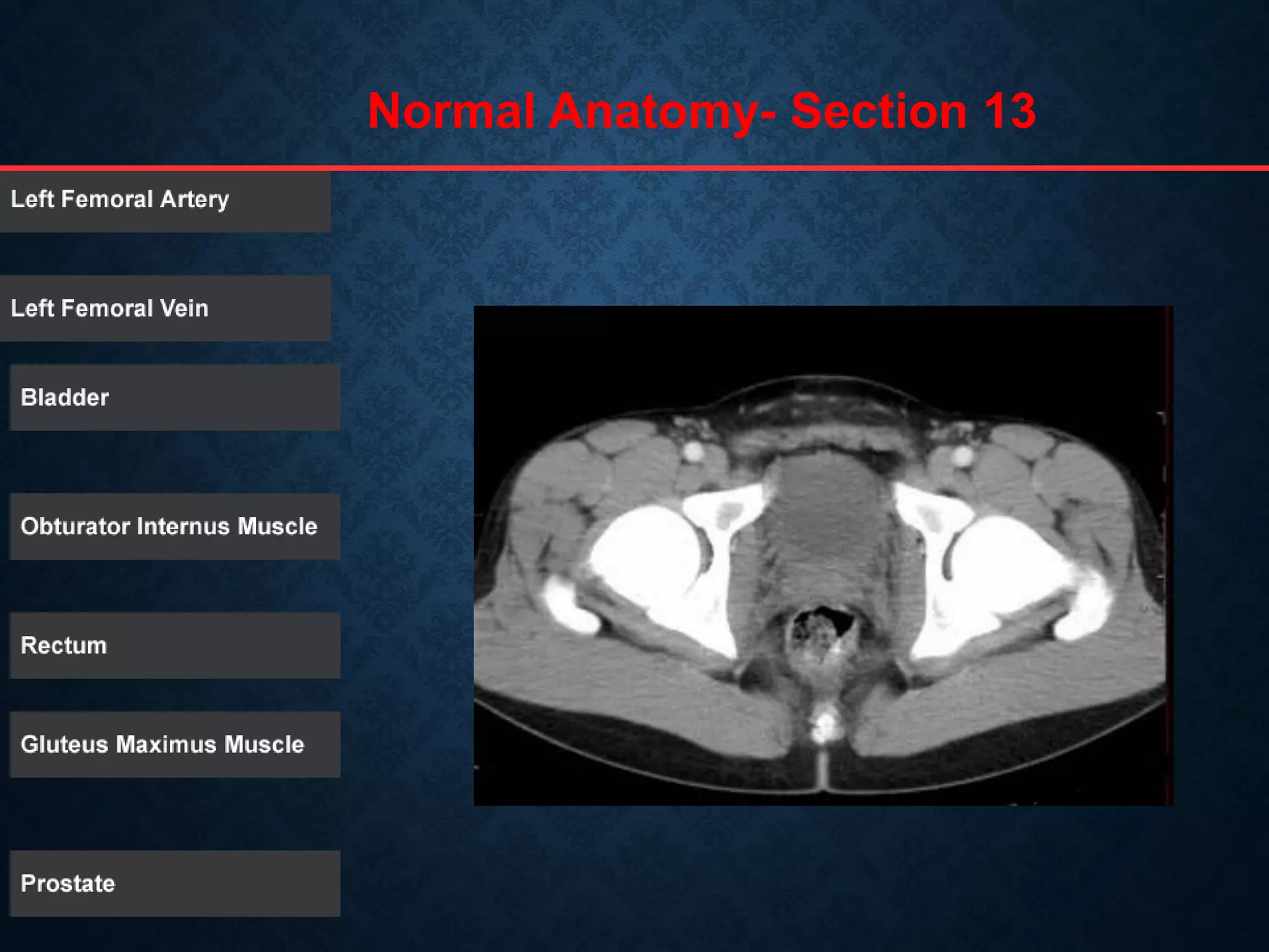 Normal Anatomy- Section 13
 