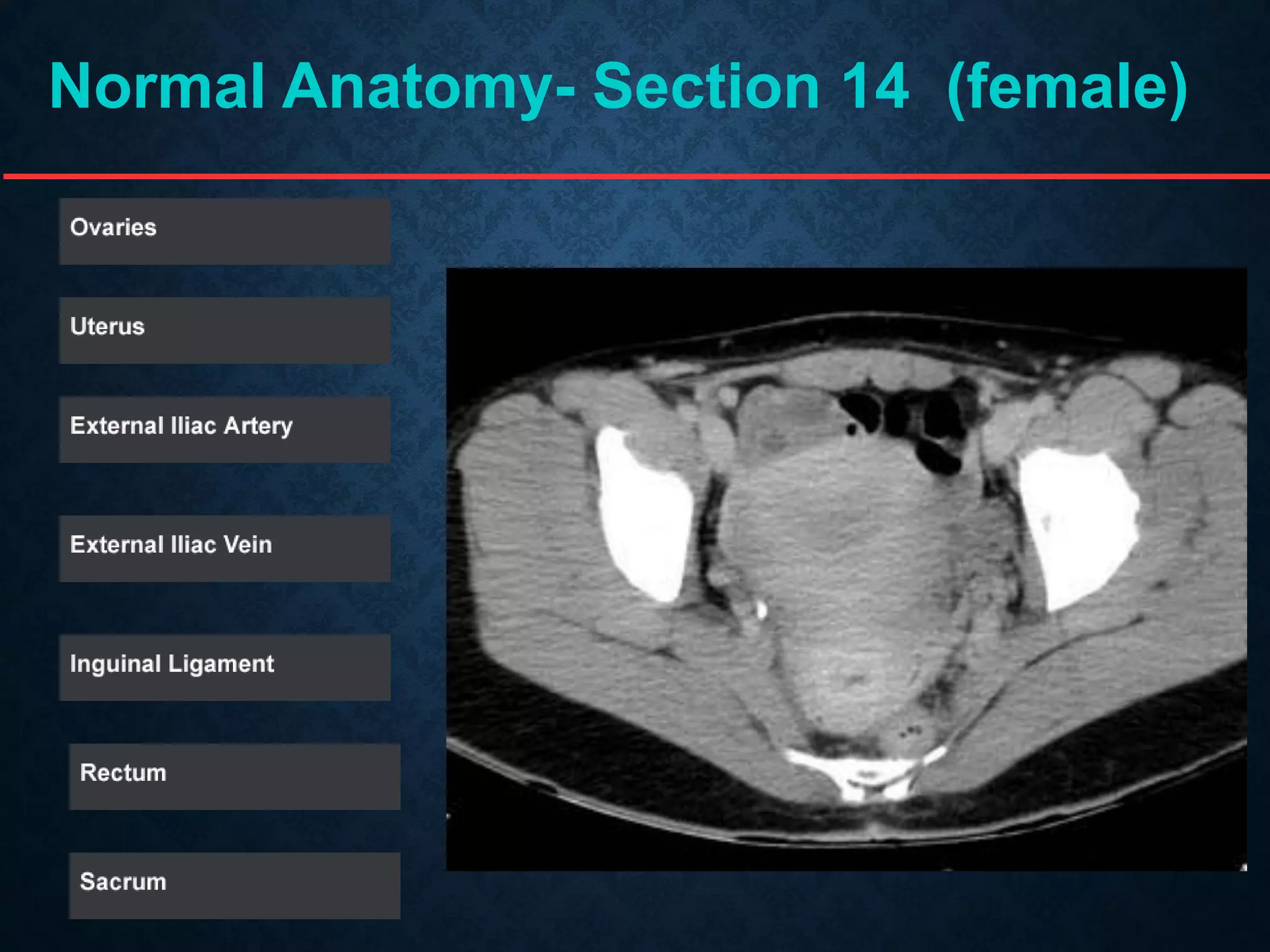 Normal Anatomy- Section 14 (female)
 
