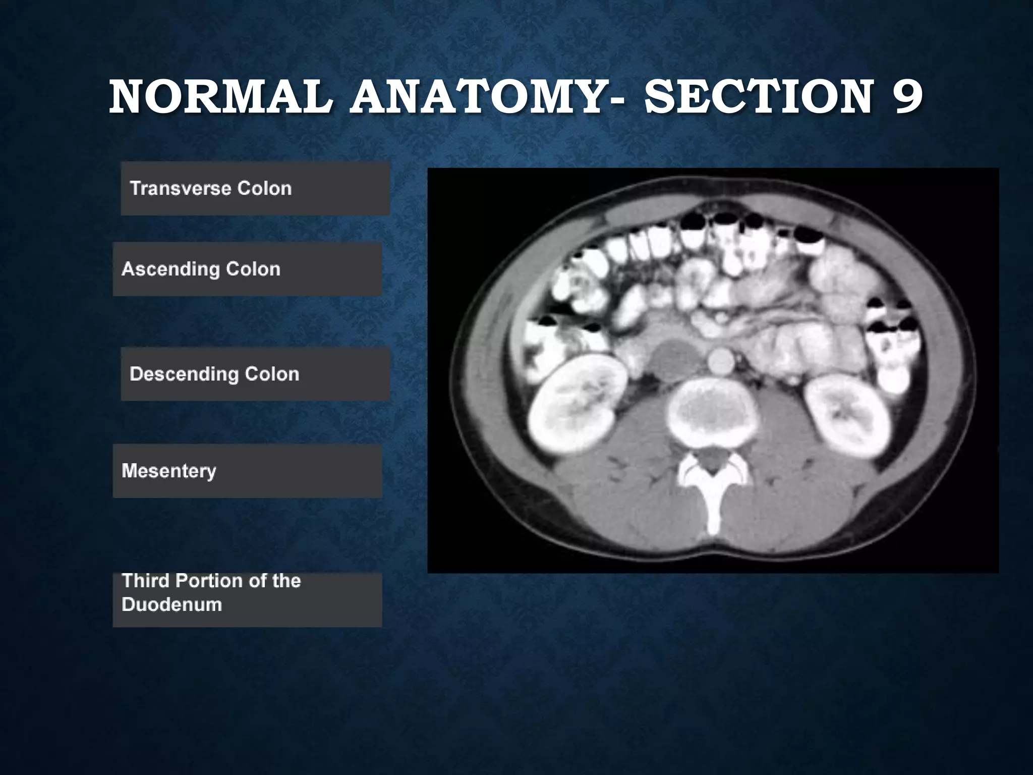 NORMAL ANATOMY- SECTION 9
 