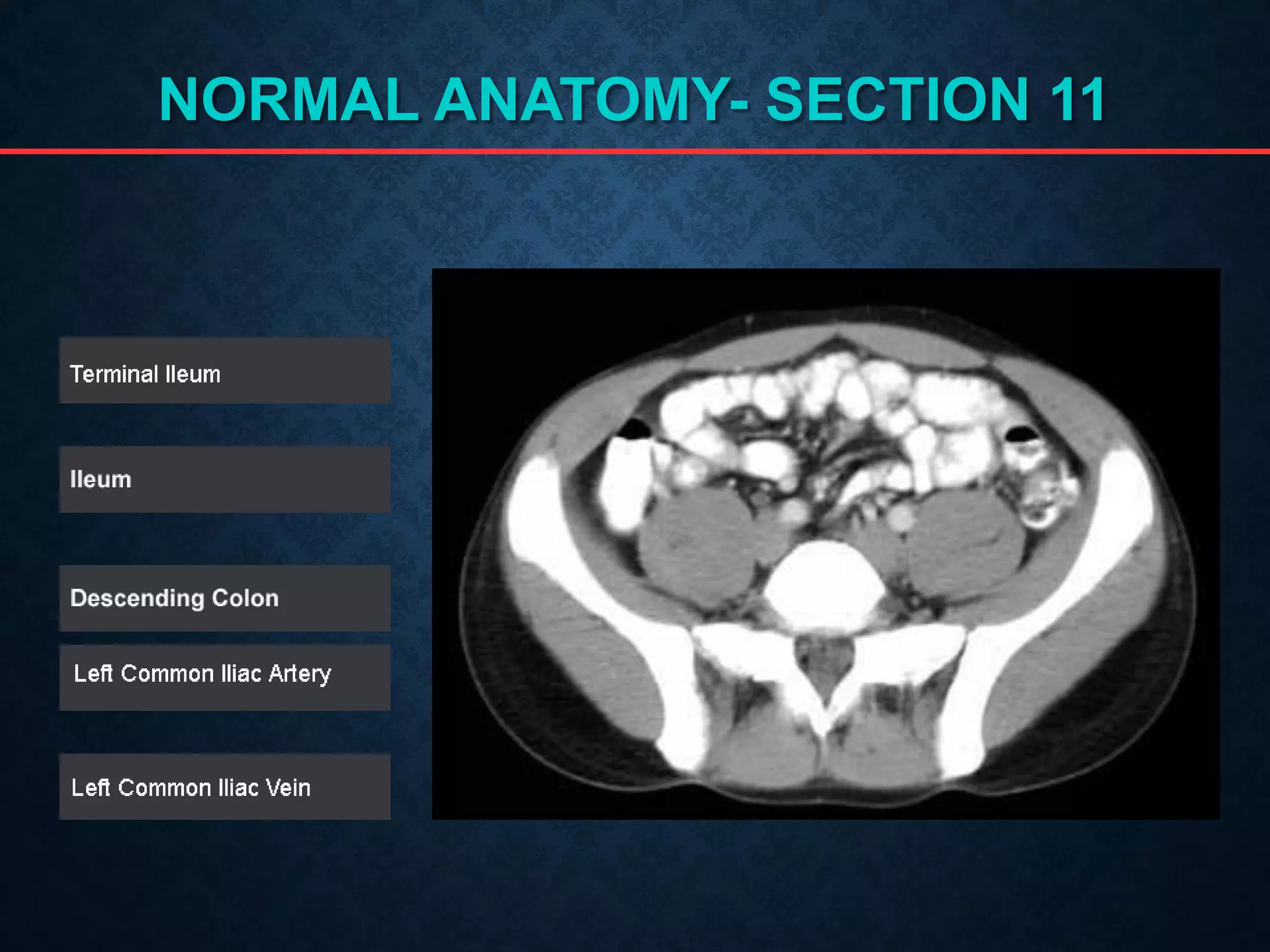 NORMAL ANATOMY- SECTION 11
 