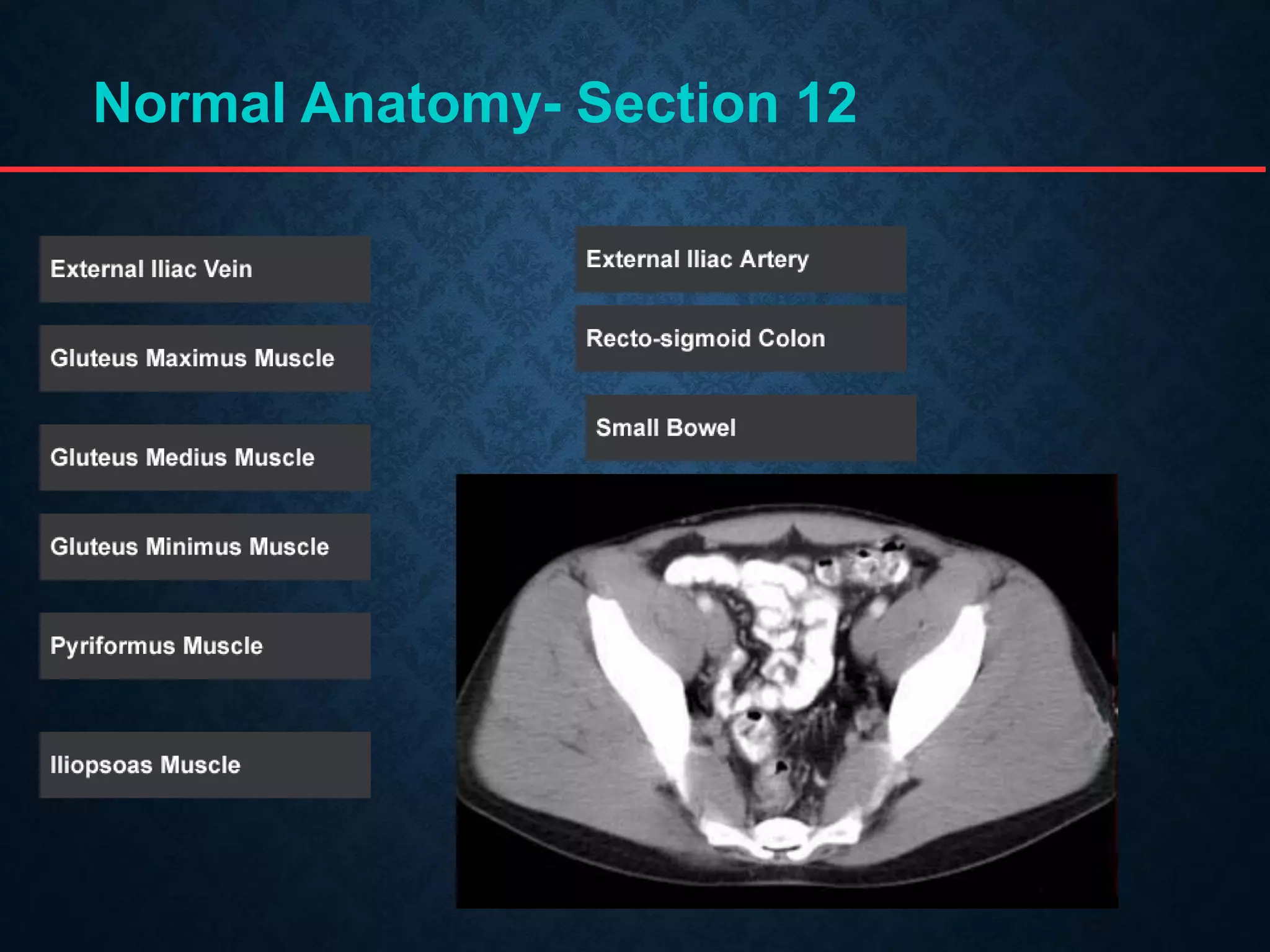Normal Anatomy- Section 12
 