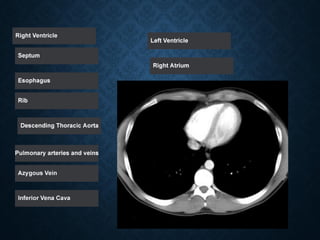 Tutorial Abdominal CT scan test.pdf