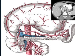Tutorial Abdominal CT scan test.pdf