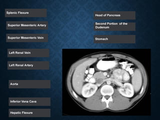 Tutorial Abdominal CT scan test.pdf