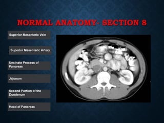 Tutorial Abdominal CT scan test.pdf