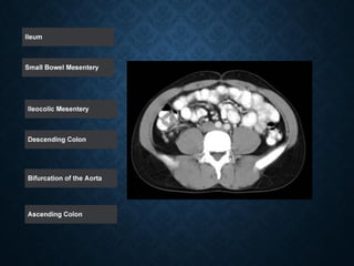 Tutorial Abdominal CT scan test.pdf