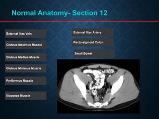 Tutorial Abdominal CT scan test.pdf