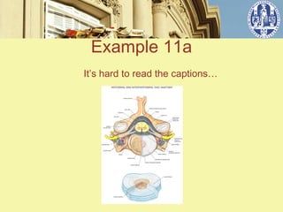 Example 11a
It’s hard to read the captions…
 