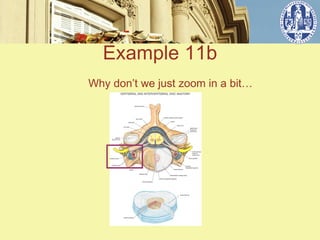 Example 11b
Why don’t we just zoom in a bit…
 