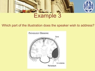 Example 3
Which part of the illustration does the speaker wish to address?
 
