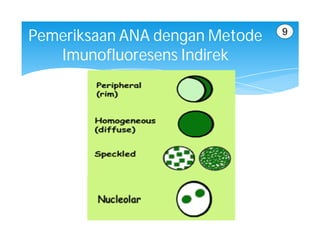 9
Pemeriksaan ANA dengan Metode
   Imunofluoresens Indirek
 