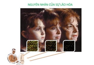 NGUYÊN NHÂN CỦA SỰ LÃO HÓA
 