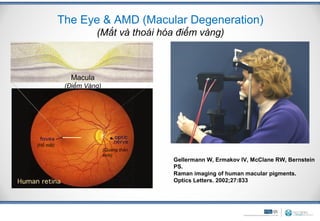 The Eye & AMD (Macular Degeneration)
                      (Mắt và thoái hóa điểm vàng)

              L&Z

             Macula
            (Điểm Vàng)




(Hố mắt)
                          (Quang thần
                          kinh)
                                        Gellermann W, Ermakov IV, McClane RW, Bernstein
                                        PS.
                                        Raman imaging of human macular pigments.
                                        Optics Letters. 2002;27:833
 