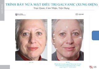 Tu van