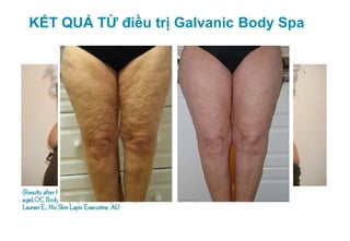 KẾT QUẢ TỪ điều trị Galvanic Body Spa




      BEFORE               AFTER
 